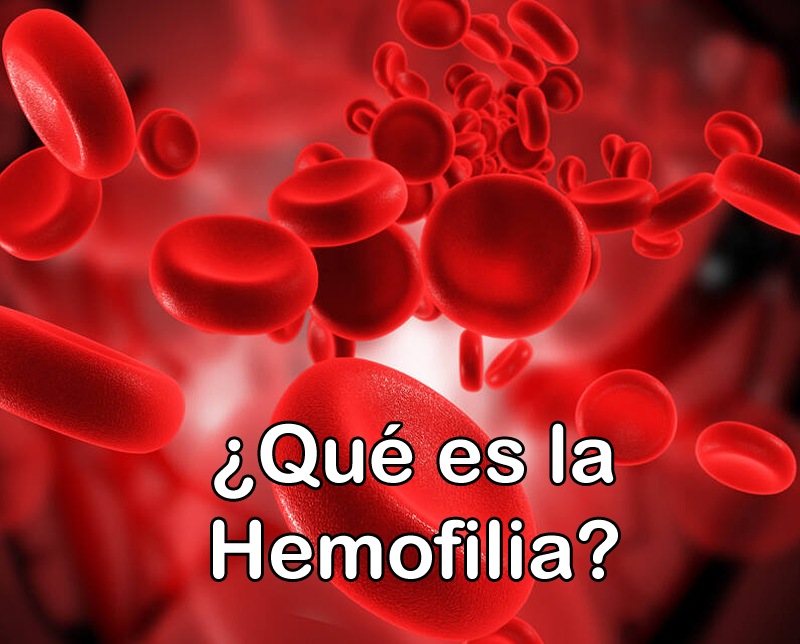 Que es la Hemofilia